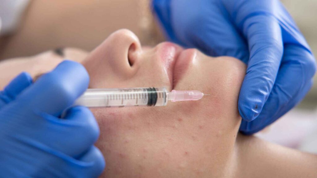 Collagen Reboot HydraFacial treatment at XienSkin London clinic
