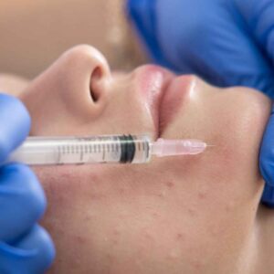 Collagen Reboot HydraFacial treatment at XienSkin London clinic