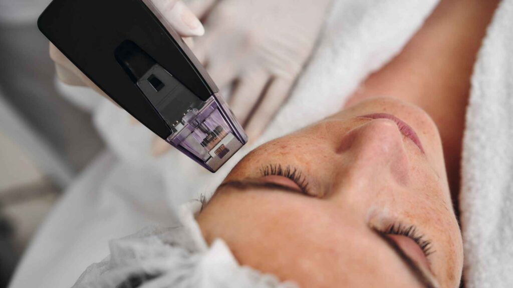 PRP PRF Bio HydraFacial London - XienSkin