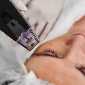 PRP PRF Bio HydraFacial London - XienSkin